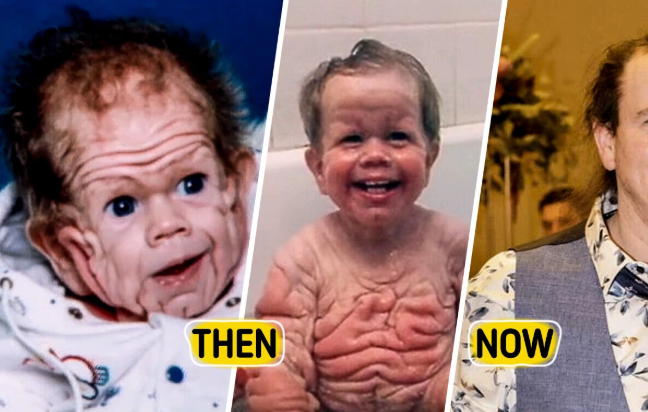 This baby was already five years old when he was born. Twenty years later