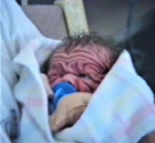 This baby was already five years old when he was born. Twenty years later