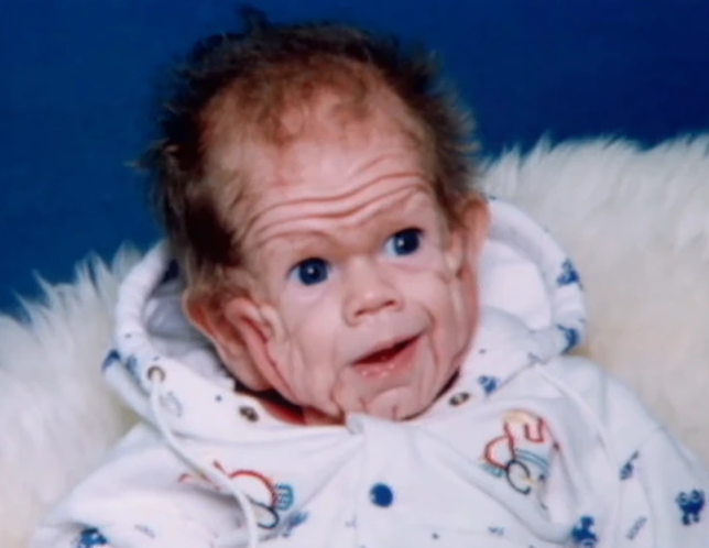 This baby was already five years old when he was born. Twenty years later