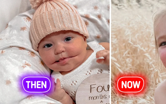  The Man With No Chin...