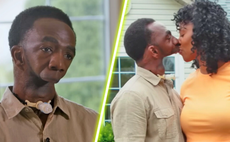 Top 10 World's Most Rare Conditions: Woman With Two Heads