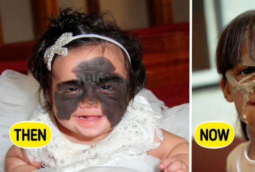  The Man With No Chin...