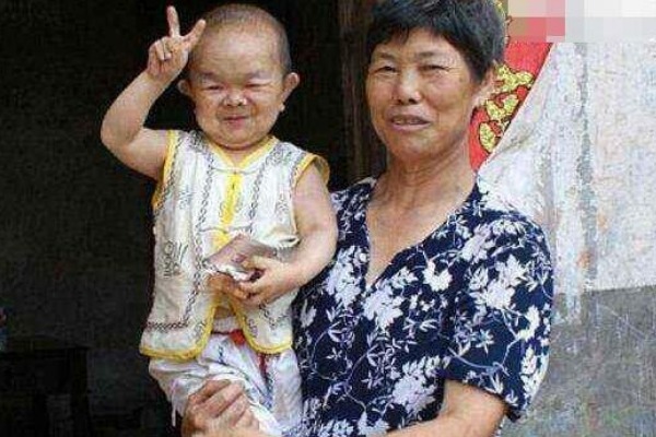 What’s the Shortest Height a Human Can Be? This Top 10 Has the Jaw-Dropping Answer